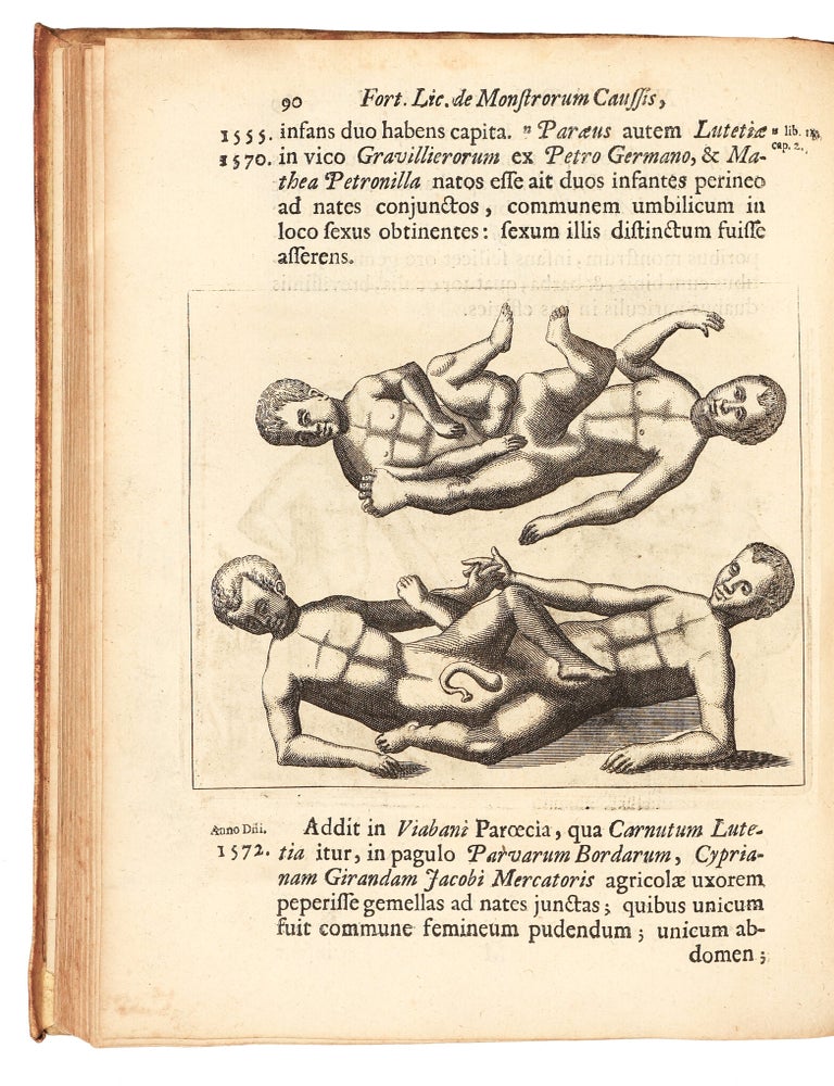 Fortunius Licetus De Monstris. Ex recensione Gerardi Blasii, M. D. & P. P. Qui Monstra quaedam nova & rariora ex recentiorum scriptis addidit. Editio Novissima. Iconibus illustrata.